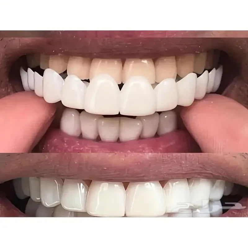 طقم الأسنان  لابتسامة طبيعية